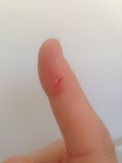 cut on finger